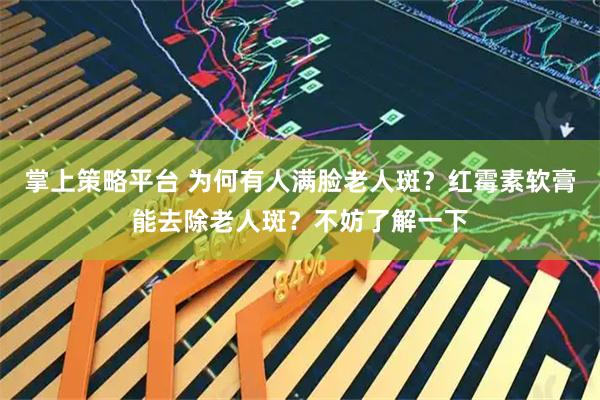 掌上策略平台 为何有人满脸老人斑？红霉素软膏能去除老人斑？不妨了解一下